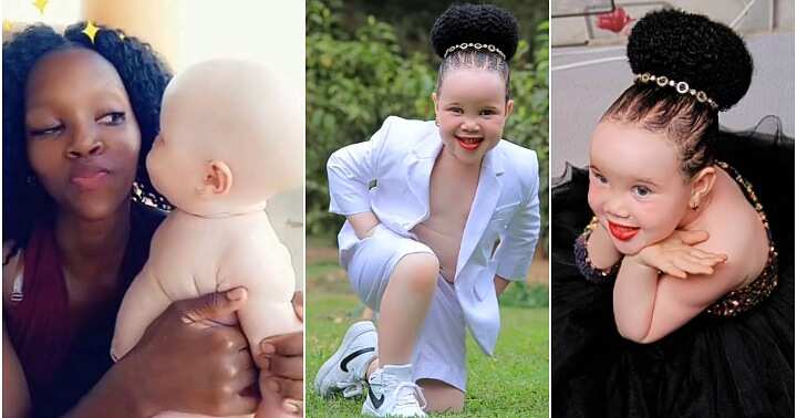 Albino girl rejected by dad, transformation