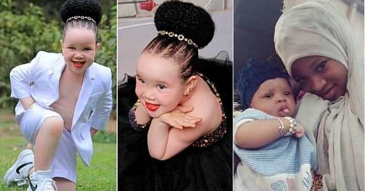 Deadbeat fathers, little girl with albinism