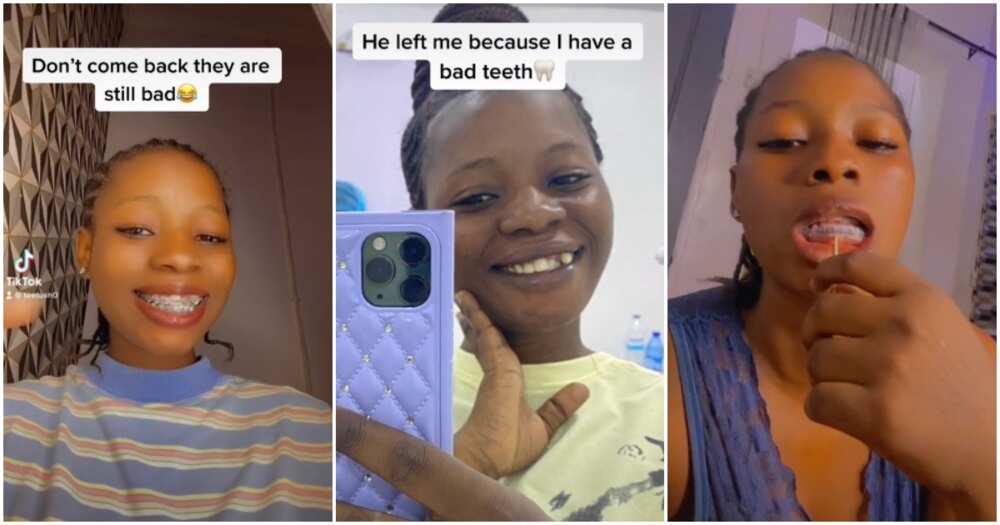 Braces, Nigerian lady, before versus after photos of lady with bad teeth, lady shows new braces