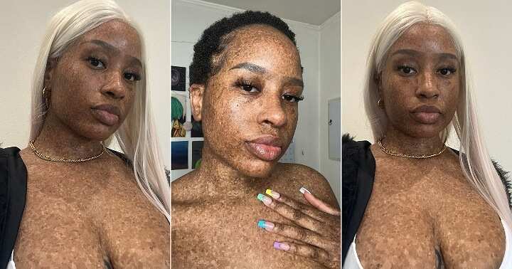 spyd Overdreven Decimal She's a Work of Art": Black Lady Posts Her Body on Twitter, Displays  Freckles On Her Skin, People React - Legit.ng