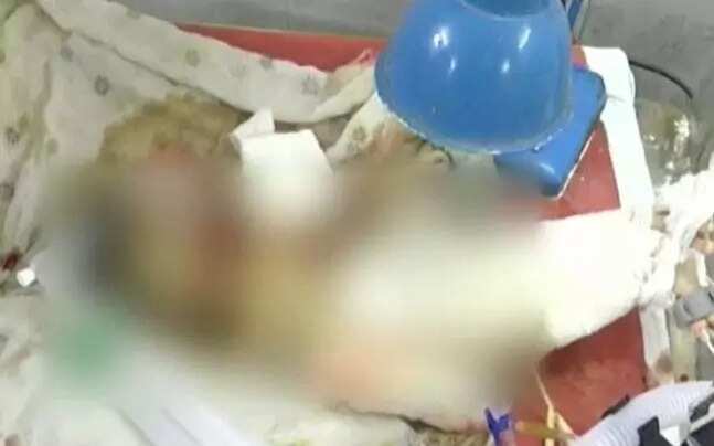 Newborn Baby Dies After Rats Ate His Eye And Fingers