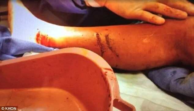 10-Year-Old Boy Survives Shark Attack By Fighting It Back