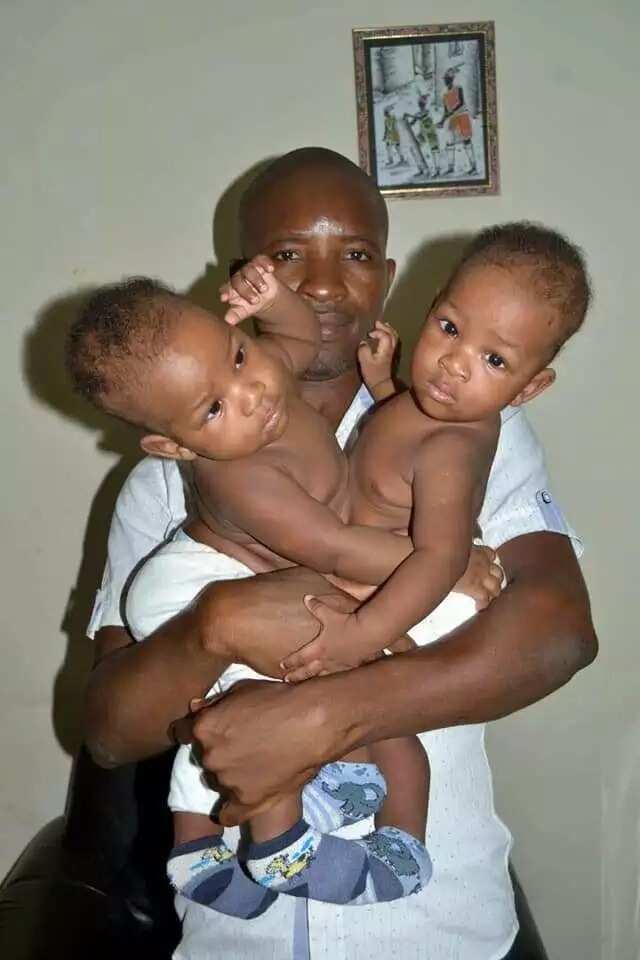 Nigerian conjoined twins separated by 22 doctors in India (photo)