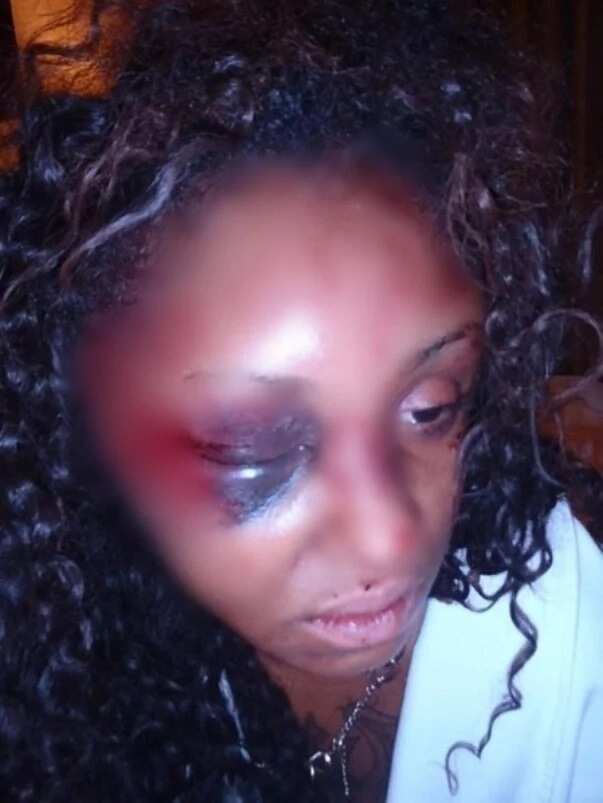 Man Beats Up Instagram Model And Got Her Brain Twisted Inside Her