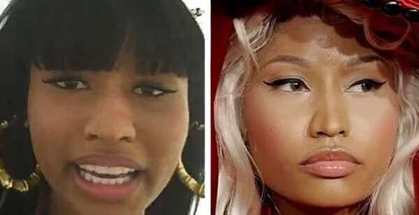 Nicki Minaj before and after