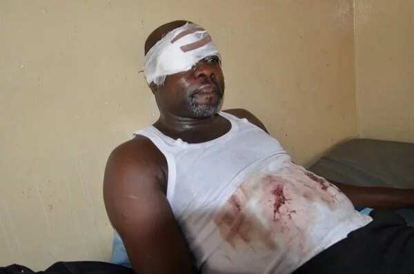 Lawyer goes blind after police assault (photo)