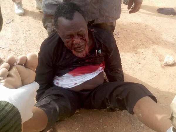 Zakzaky Reveals What Really Happened