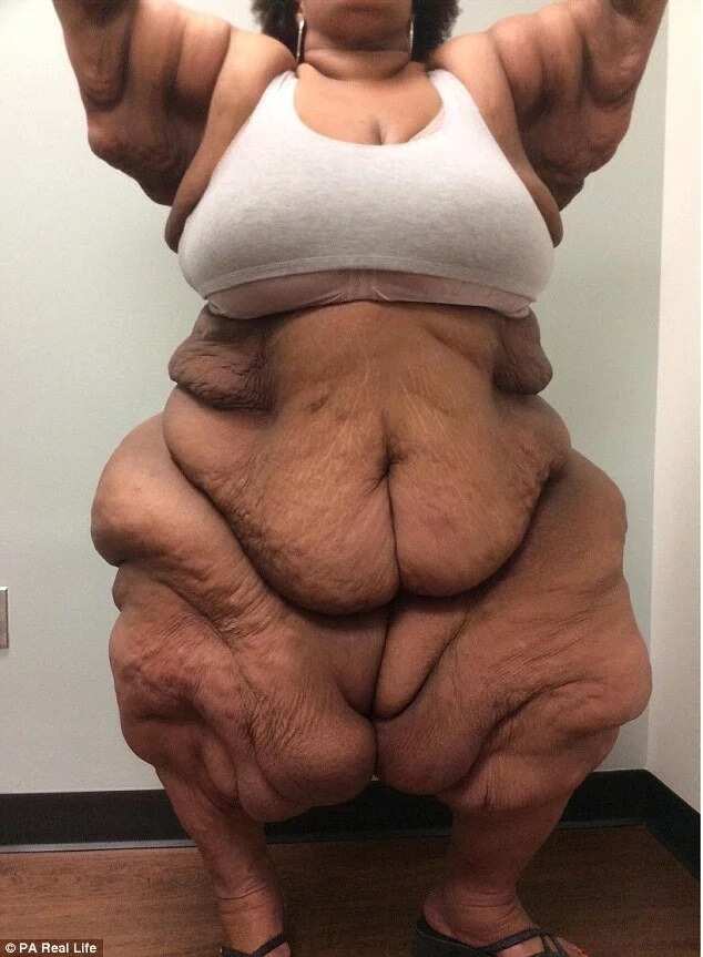 Former world's fattest woman looking for love after loosing 260kg Former world's fattest woman looking for love after loosing 260kg