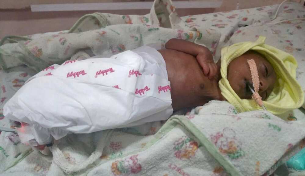 Newborn Baby Abandoned By Parents Due To Wrinkly Skin
