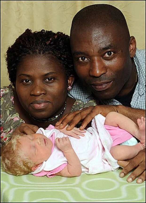 Baby eye white black couple black Black Eye: