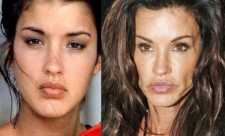 Top 15 celebrities' plastic surgery fails Legit.ng