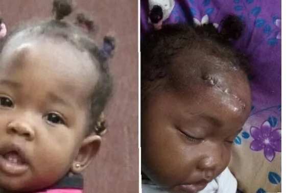 Nigerian mother cries out after surgery leaves her daughter with large facial scars (Photos)