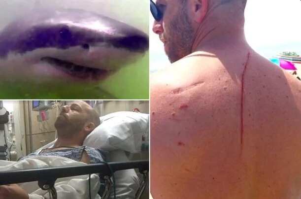 Shark Helps Man To Discover Cancerous Tumour On Kidney
