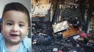 18-Month Old Baby Burnt Alive