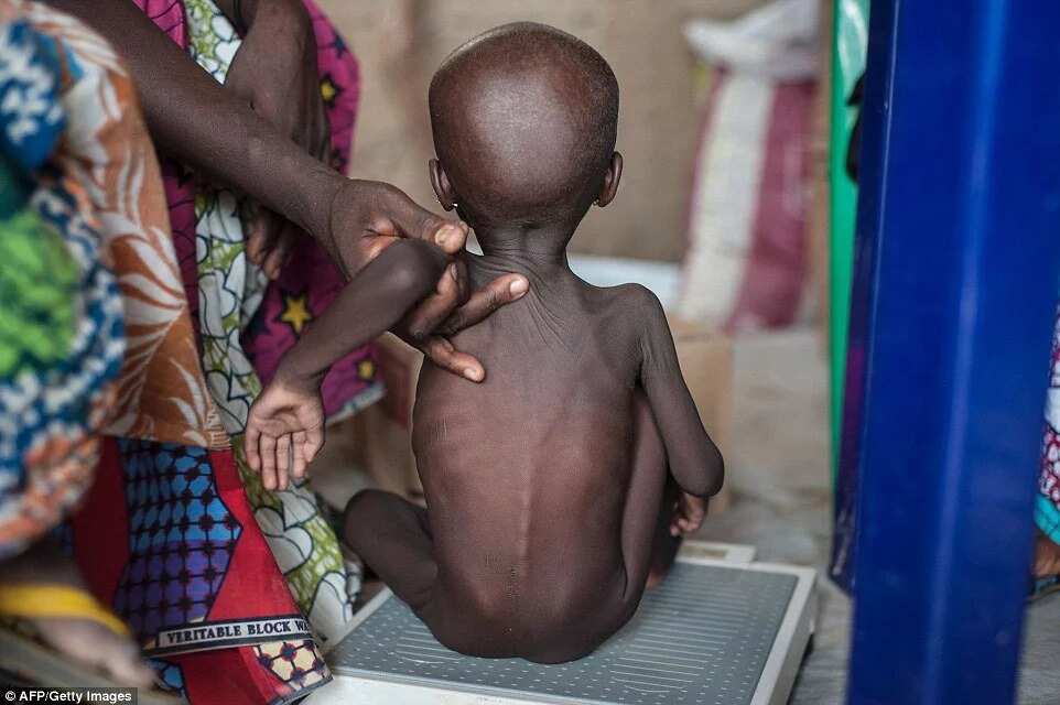 Malnutrition crisis hits IDP camps in Borno