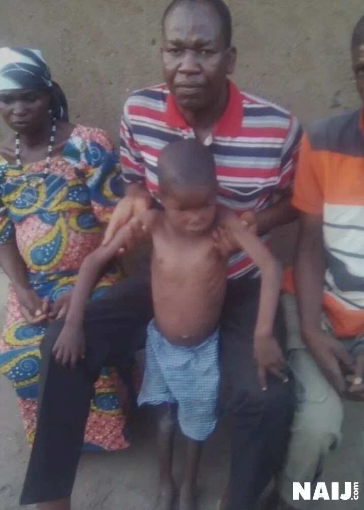 6-year-old Chibok boy in need of N19m after Boko Haram bike man broke his back bone (photos)
