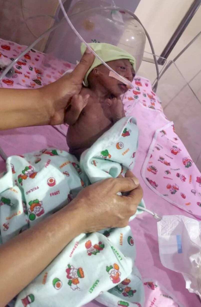 Newborn Baby Abandoned By Parents Due To Wrinkly Skin