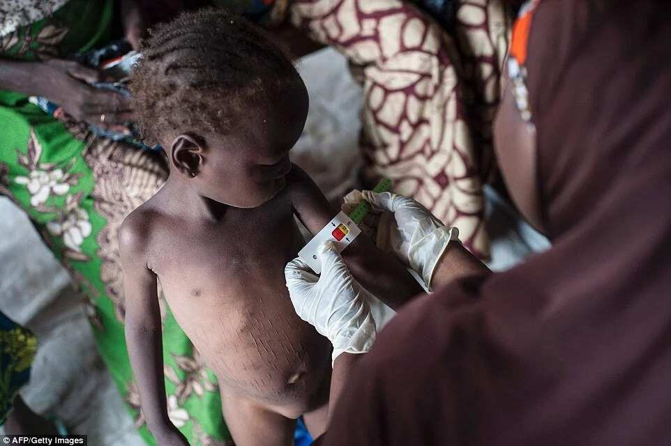 Malnutrition crisis hits IDP camps in Borno