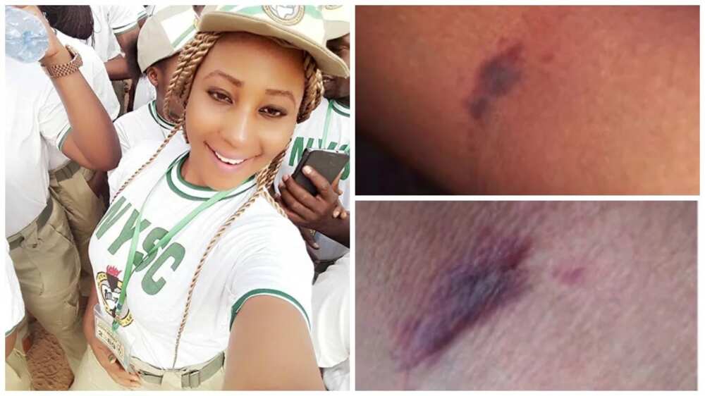 How an NYSC official brutalized me for not wearing my jacket – Female corp member cries out (photos)