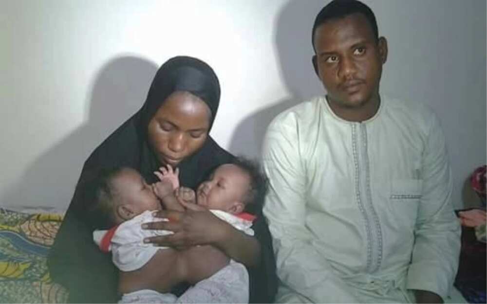 Team of surgeons successfully separate conjoined twins in Yola